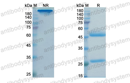 Валидация SDS-PAGE - AntibodySystem DHH18501