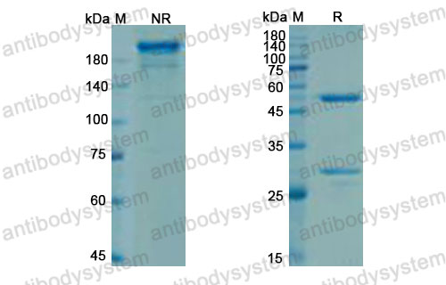 Валидация SDS-PAGE - AntibodySystem DHH72405