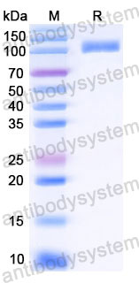 EHC33002, SDS-PAGE