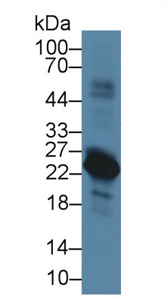 10151