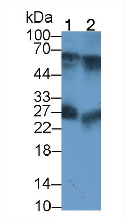 21238