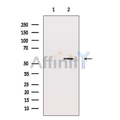 Валидация Affinity AF6382 - 3678