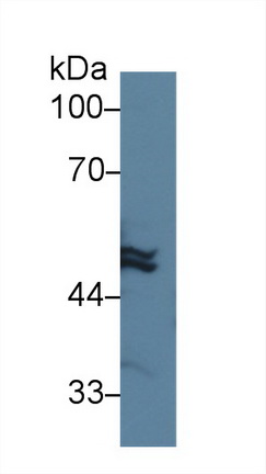 14000