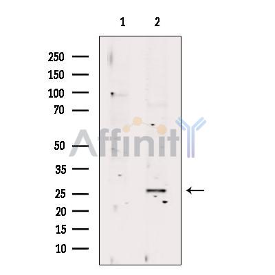 Валидация Affinity DF9821 - 22707