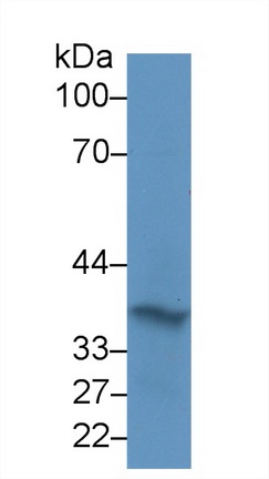 15260