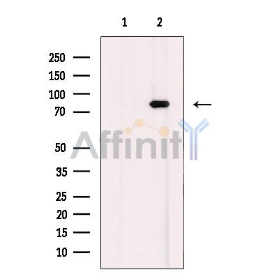 Валидация Affinity DF10337 - 5960