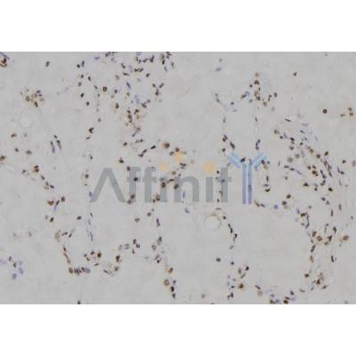 Валидация Affinity DF3142 - 13935