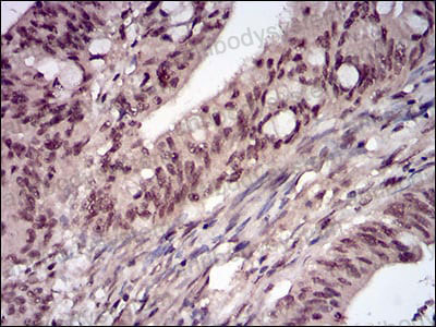 Валидация AntibodySystem RHF48403