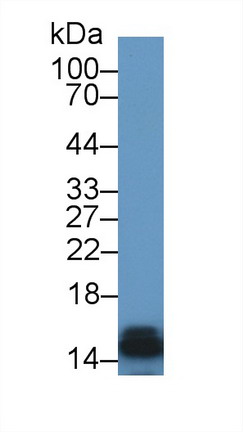 9191