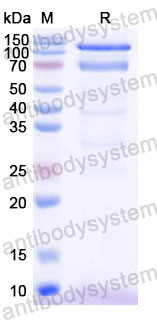 Валидация SDS-PAGE - AntibodySystem DHC90721