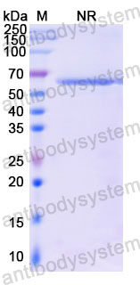 Валидация SDS-PAGE - AntibodySystem DHF92404