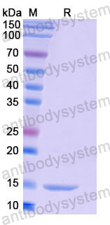Валидация SDS-PAGE - AntibodySystem RHF52802