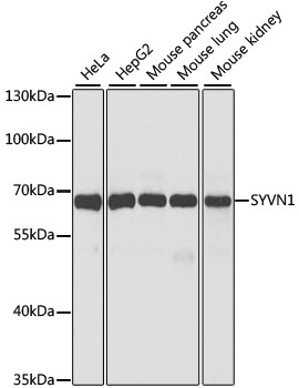 Валидация Elabscience E-AB-62548
