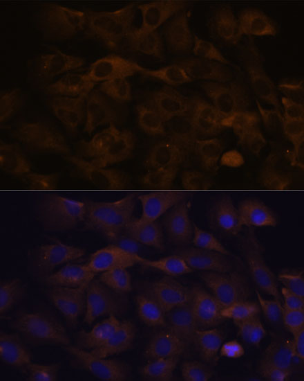 A18227, иммунофлуоресценция, клетки C6 (12606)