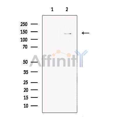 Валидация Affinity DF13303 - 8445