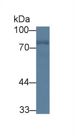 14127