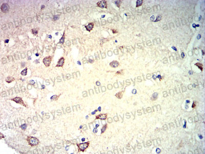 Валидация AntibodySystem RHJ71902
