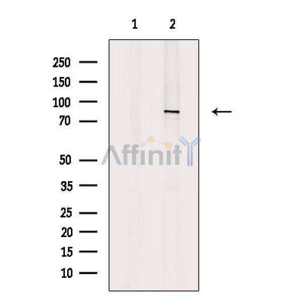 Валидация Affinity DF2544 - 13206