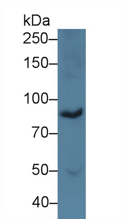 14222