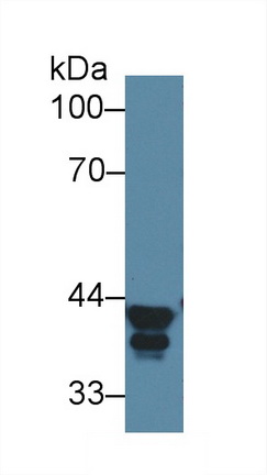 52182