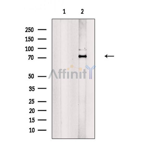 Валидация Affinity DF2396 - 12988