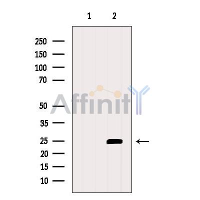 Валидация Affinity DF6703 - 18214