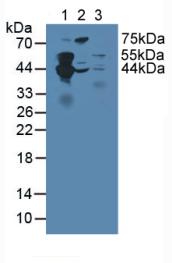 5761