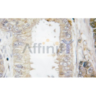 Валидация Affinity AF6139 - 3360