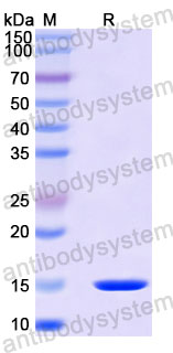 Валидация SDS-PAGE - AntibodySystem RWN10402