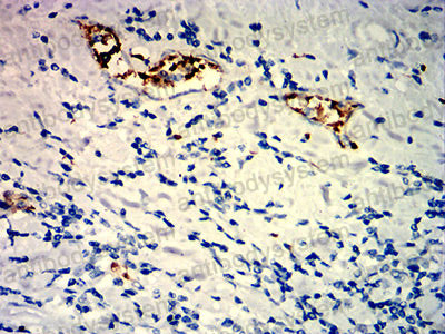 Валидация AntibodySystem RHN98002 (4025)