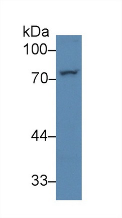 12423