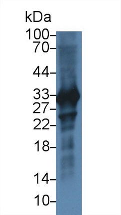 14921
