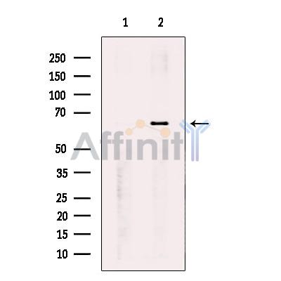 Валидация Affinity DF10318 - 5939