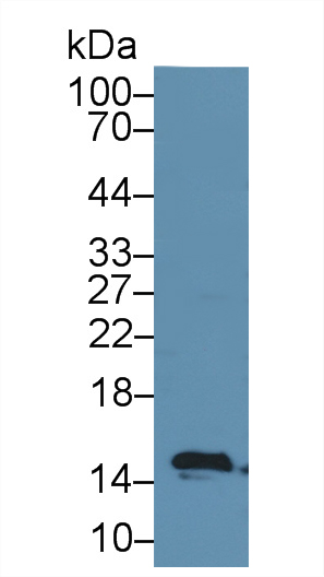 17593