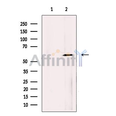Валидация Affinity DF13227 - 8262