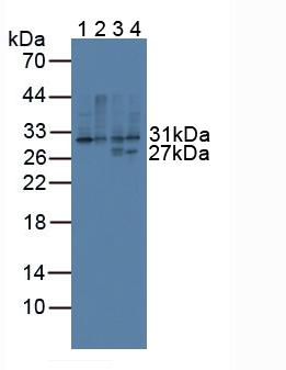 5723