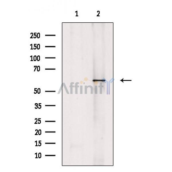 Валидация Affinity DF2268 - 12820