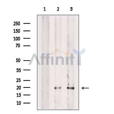 Валидация Affinity DF13314 - 8472