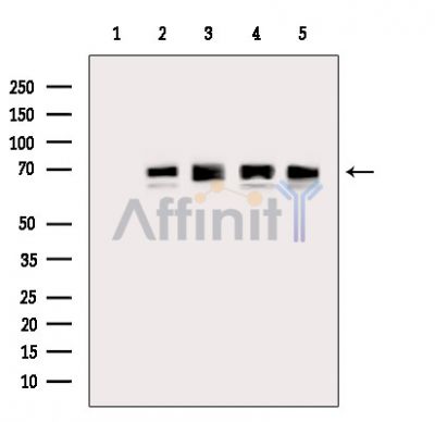 Валидация Affinity DF14046 - 9821