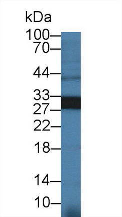 9612