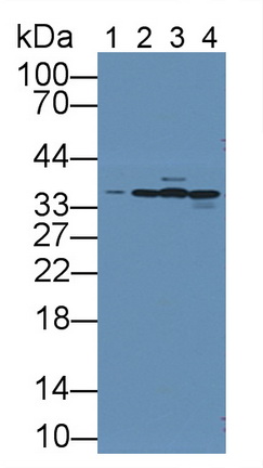 11935