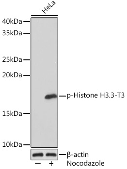AP1152, вестерн-блоттинг, лизат клеток HeLa (27893)
