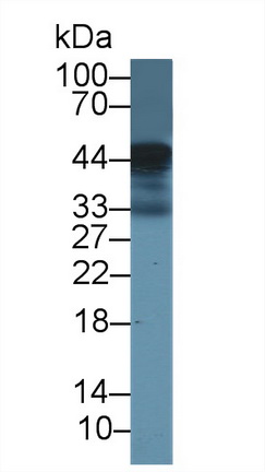14423
