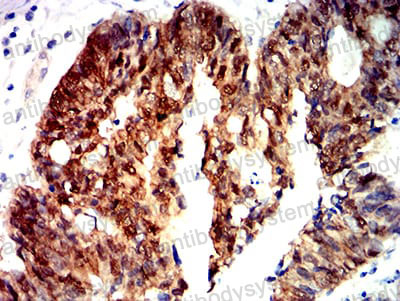Валидация AntibodySystem RHE07607