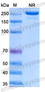 Валидация SDS-PAGE - AntibodySystem RHJ92830