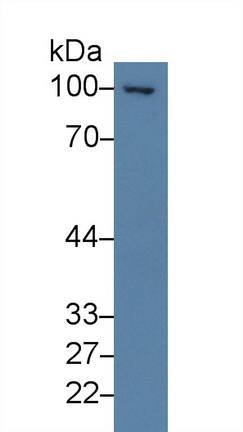 14233