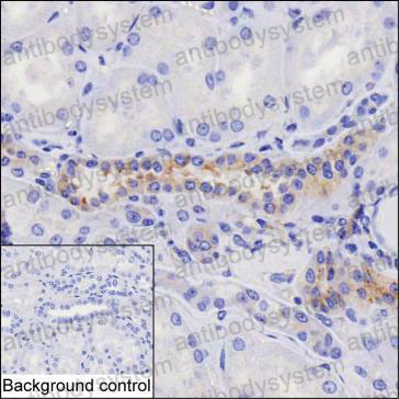 Валидация AntibodySystem RHA08102