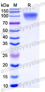 EHC34008, SDS-PAGE