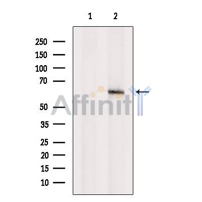 Валидация Affinity DF2555 - 13223
