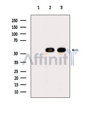 Валидация Affinity AF6934 - 4118